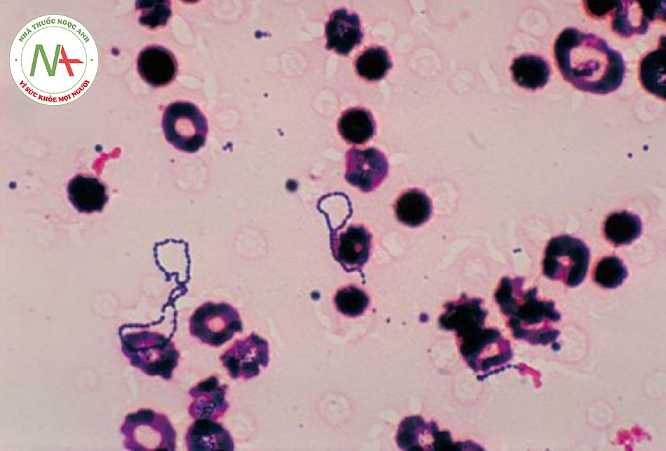 Hình 2: Ảnh chụp hiển vi loài vi khuẩn Streptococci viridans đã tăng sinh trong khay cấy máu.