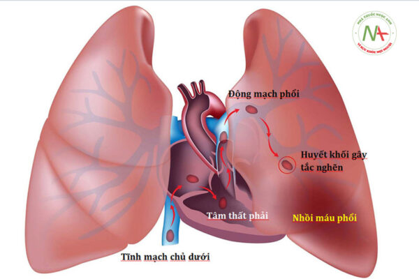 Tĩnh mạch phổi