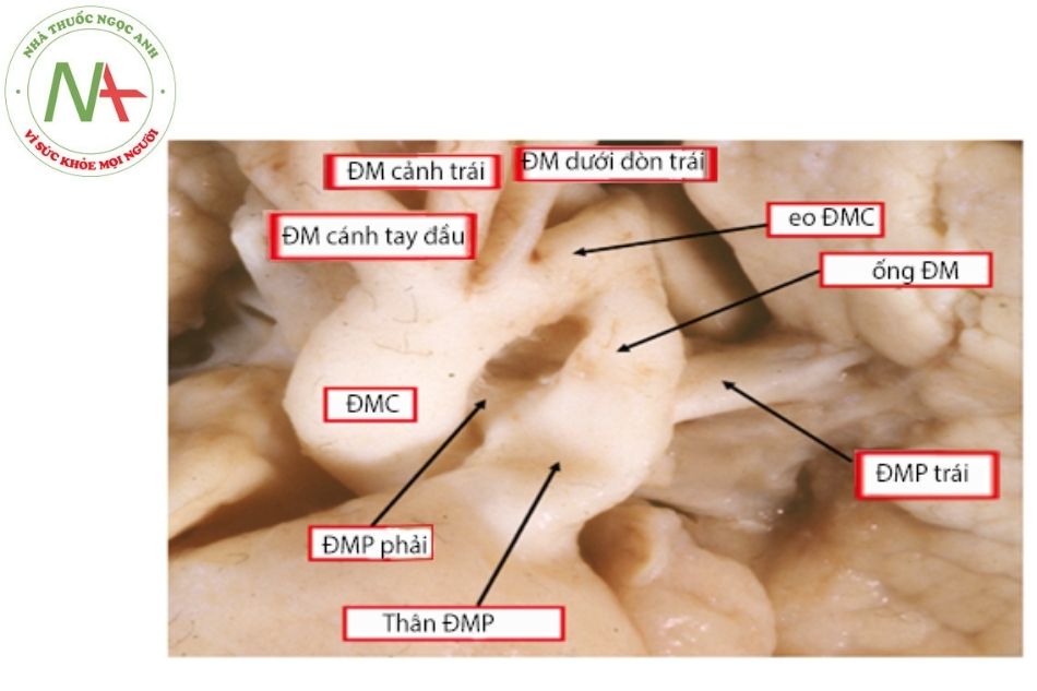 Hình 1. Hình ảnh giải phẫu ống động mạch