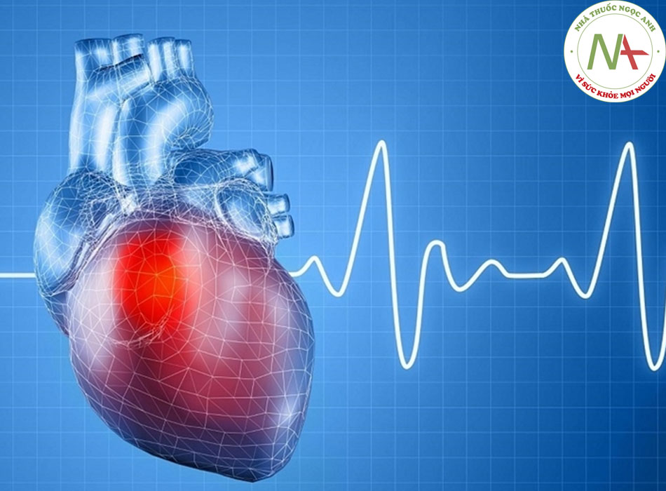 CRT: biện pháp trong điều trị suy tim từ sinh lý bệnh đến lâm sàng