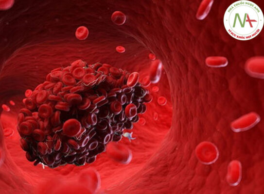 Xử trí biến chứng xuất huyết do kháng đông và vai trò chất hóa giải NOAC