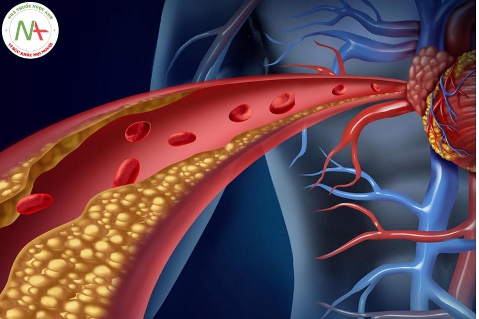 Cholestyramine hoạt động bằng cách liên kết với axit mật trong lòng ruột
