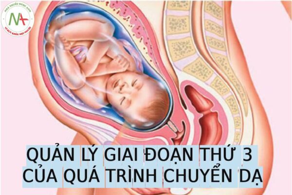 Quản lý giai đoạn thứ ba của quá trình chuyến dạ sau sinh ngả âm đạo