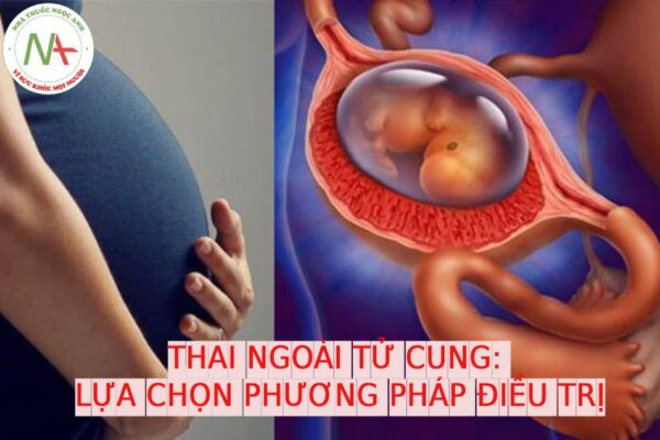 Thai ngoài tử cung: Lưa chọn phương pháp điều trị