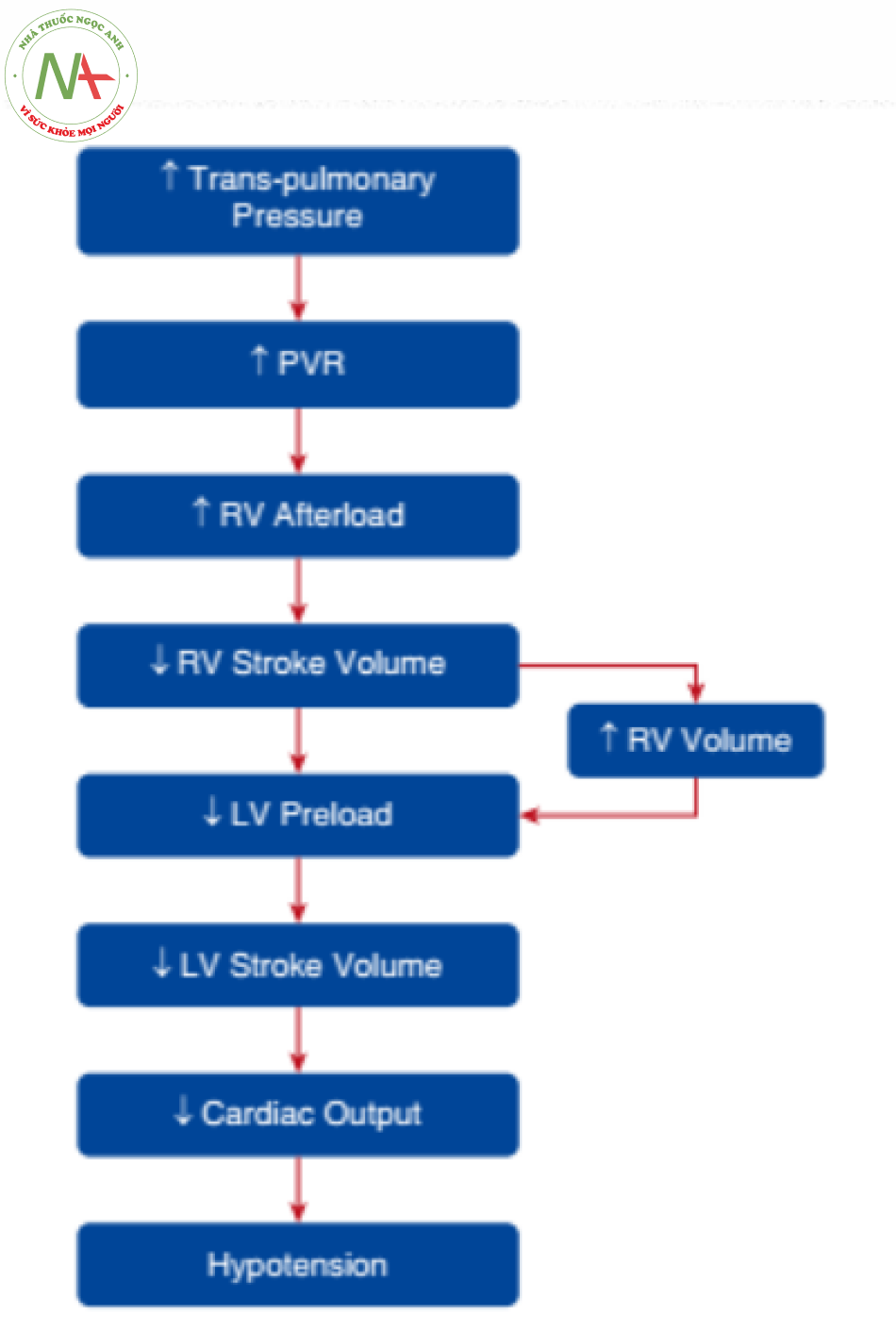 Hình 6. Biểu đồ cho thấy ảnh hưởng của thở máy lên huyết động thất phải (RV) dẫn đến tụt huyết áp toàn thân. LV = thất trái; PVR = sức cản mạch máu phổi.