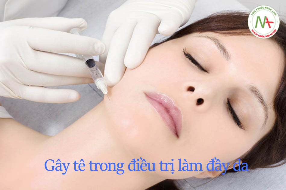 gây te làm đầy da