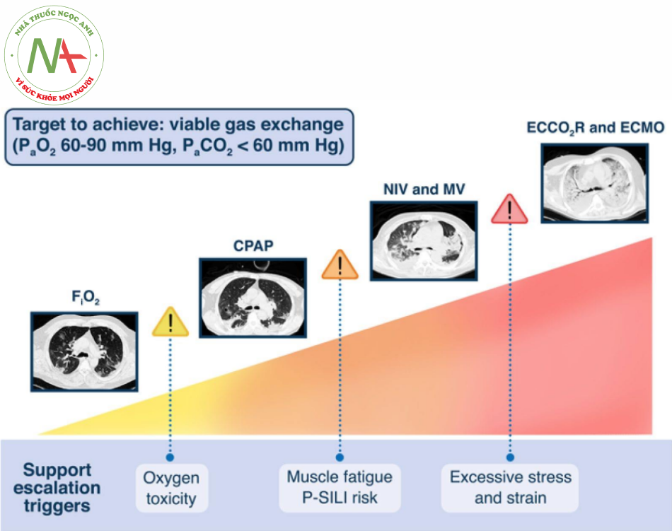 Hình 1. Khung khái niệm về sự tương tác giữa các kỹ thuật hỗ trợ hô hấp và nền tảng sinh lý. Như đã trình bày, cùng một mục tiêu đòi hỏi các kỹ thuật khác nhau tùy thuộc vào tình trạng sinh lý của phổi. Hình ảnh chụp cắt lớp vi tính (CT) đại diện cho thấy. Từ trái sang phải, mô đông / không được thông khí chiếm 5–12–34–63%. Các yếu tố kích hoạt hỗ trợ hô hấp leo thang cũng được chỉ định. Việc bổ sung áp lực dương (CPAP) nhằm làm giảm xẹp phổi và do đó tĩnh mạch trộn cải thiện và hạn chế nguy cơ nhiễm độc oxy và tái hấp thu gây thêm xẹp phổi nếu FiO2 gần bằng 1. Khi thể tích khí của phổi giảm (phổi trở nên nặng hơn và compliance thấp hơn) nỗ lực di chuyển phổi tăng lên và hỗ trợ thông khí bổ sung là cần thiết hoặc không xâm lấn hoặc xâm lấn. Cuối cùng, với một tình trạng máu tĩnh mạch trộn (shunt) rất lớn và tình trạng giảm oxy máu kháng trị, hỗ trợ màng ngoài cơ thể là lựa chọn khả thi duy nhất. PaO2: áp suất riêng phần của oxy trong động mạch, PaCO2: áp suất riêng phần của carbon dioxide trong động mạch, FiO2: phần oxy thở vào, CPAP: áp lực đường thở dương liên tục, NIV: thông khí không xâm nhập, MV: thở máy, ECCO2R: loại bỏ CO2 với màng ngoài cơ thể, ECMO : oxy hóa phổi qua màng ngoài cơ thể, P-SILI: bệnh nhân tự gây chấn thương phổi.
