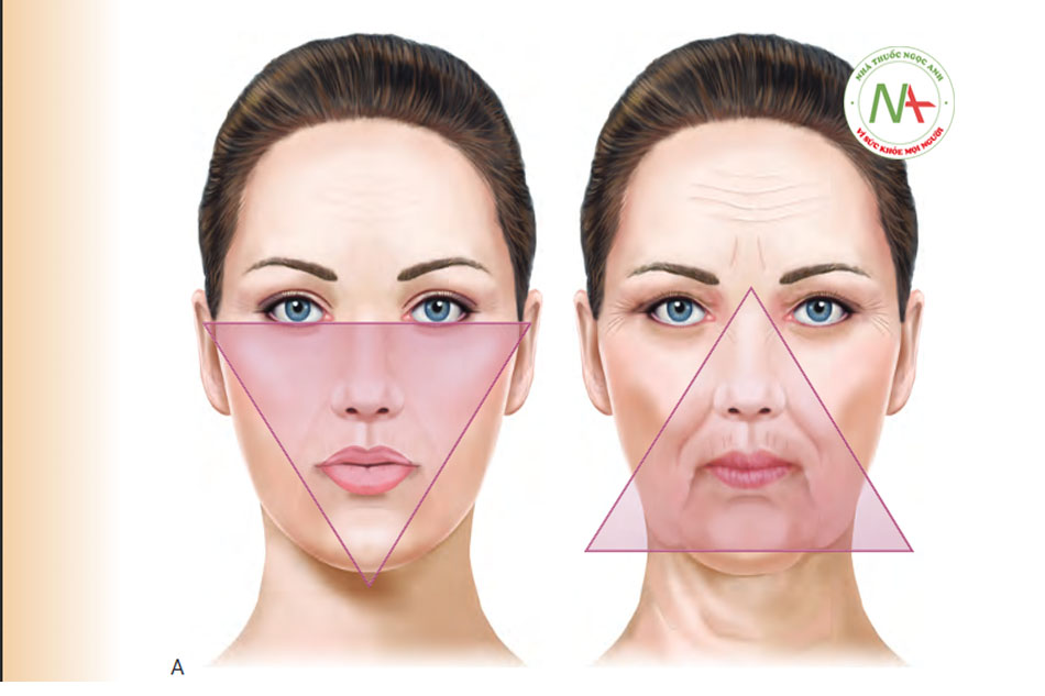 AFIGURE 3 ●Quá trình lão hóa của các đường nét trên khuôn mặt từ trẻ trung (A) đến có tuổi (B)