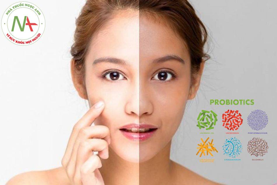 Vai trò cơ chế của Probiotics trong cải thiện sức khỏe làn da