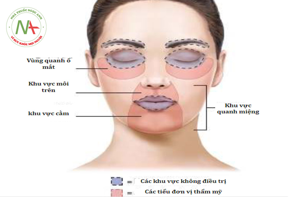 HÌNH 6 Các vùng thẩm mỹ nhỏ trên mặt thường được điều trị với laser tái tạo bề mặt da phân đoạn không xâm lấn.