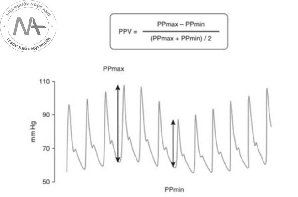 Hình 3. Tính toán sự thay đổi áp lực mạch (PPV) từ đường cong áp lực động mạch. PP = áp lực mạch.