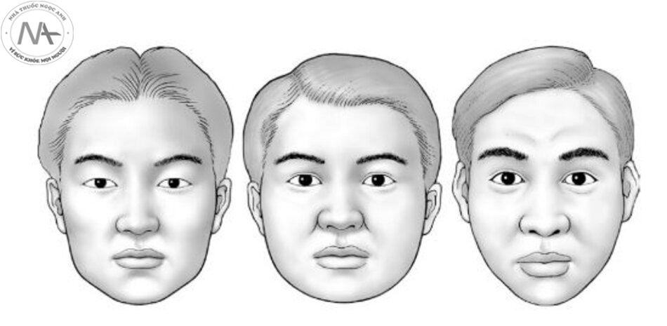Hình 1.16 Hình thái khuôn mặt của người châu Á gồm các kiểu khuôn mặt miền bắc, miền trung và miền nam (từ trái sang phải).