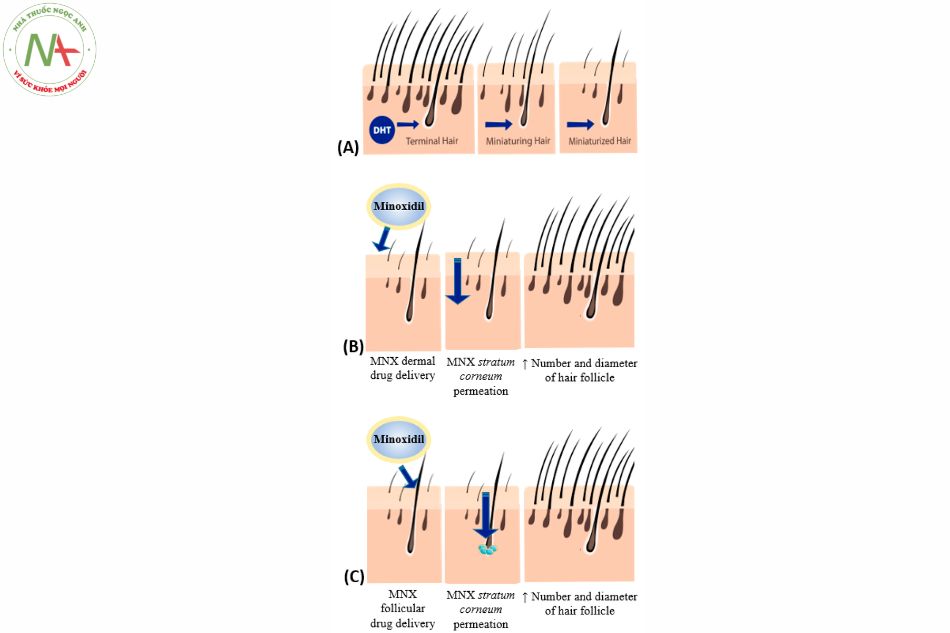Cơ chế hoạt động chính xác của minoxidil để điều trị chứng rụng tóc tại chỗ vẫn chưa được hiểu rõ