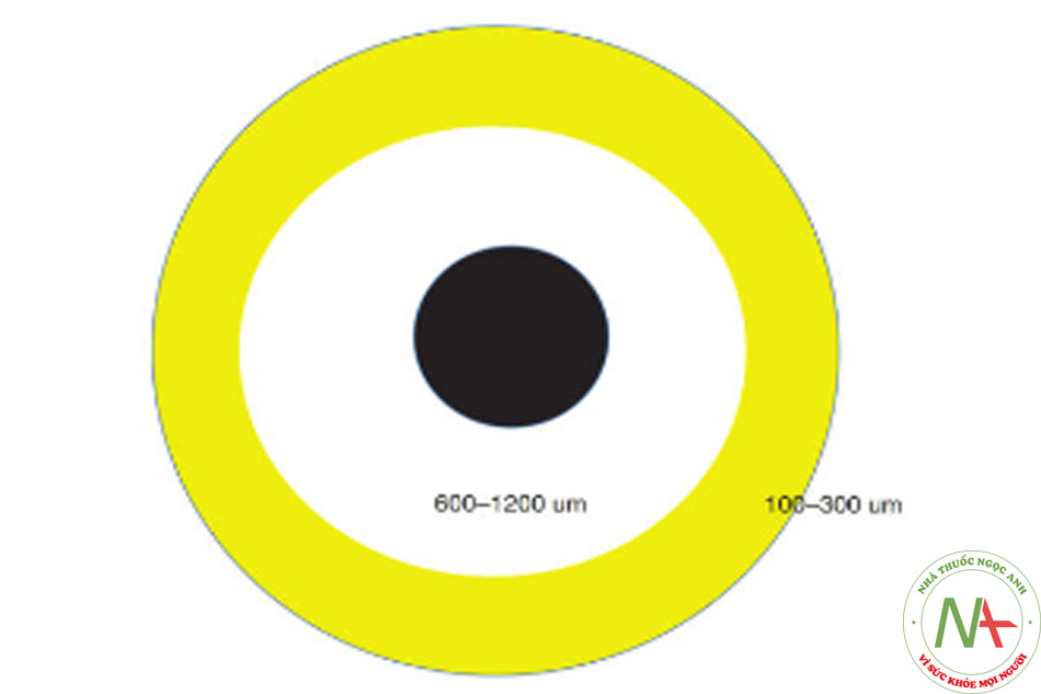Hình 2.1 Màu vàng: phần sống sót 100–300 μm là lớp gần nhất với bề mặt nơi tất cả các tế bào mỡ tồn tại. Màu trắng: phần tái sinh 600–1200 μm là lớp giữa nơi các tế bào mỡ chết đi nhưng được thay thế bằng các tế bào gốc đang tăng sinh. Màu đen: phần hoại tử, nhân trung tâm của hạt mỡ bị chi phối bởi các vết hoại tử, nang dầu và xơ hóa. (Được xuất bản dưới sự cho phép của © Mario Goisis 2018. Mọi quyền được bảo lưu