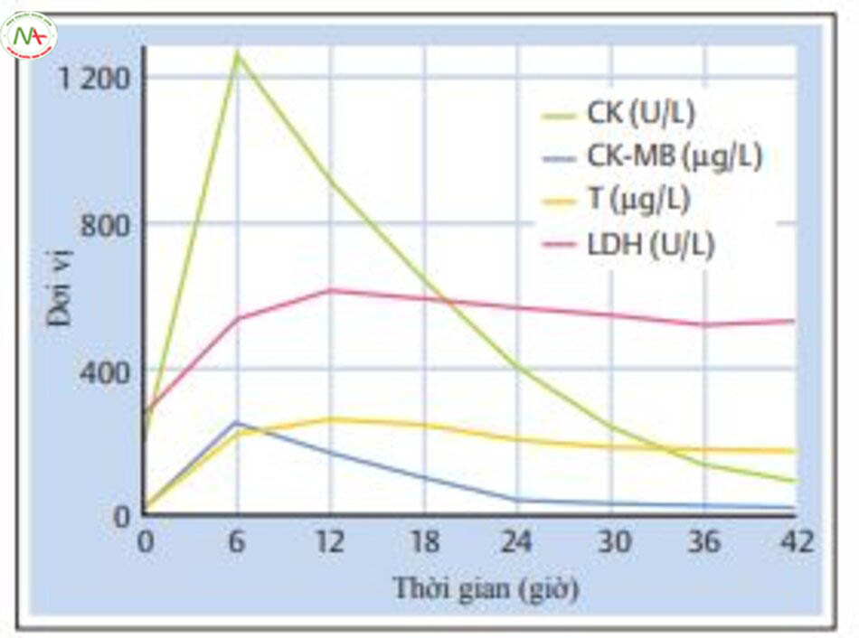 Hình 6.17 Dạng điển hình phóng thích các enzym trên bệnh nhân nhồi máu cơ tim cấp. CK = creatine kinase; CK-MB = MB = phân đoạn MB của creatine kinasee; T = troponin T; LDH = lactate dehydrogenase. 