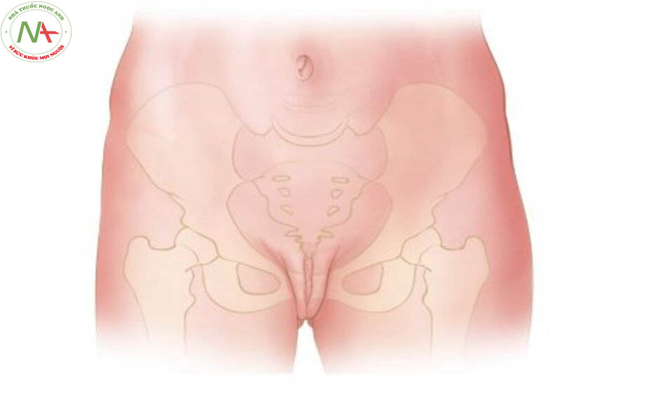 Hình. 1-2 Tương quan giữa xương/khớp mu và CQSDN của nữ.