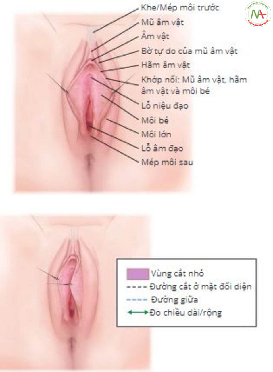 Hình. 7-4 Giải phẫu bộ phận sinh dục nữ