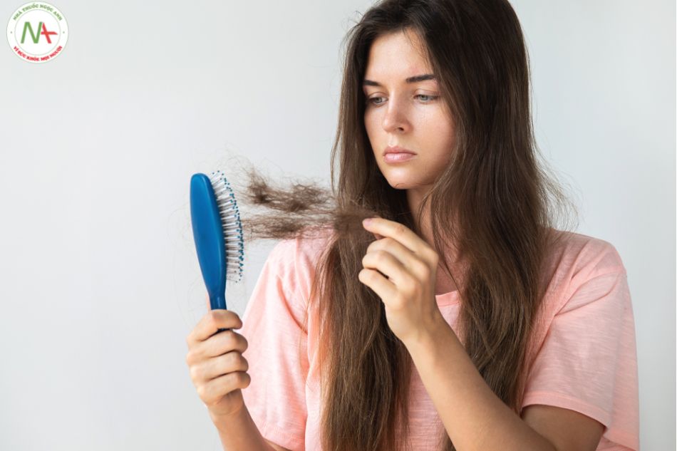 Rụng tóc nhiều là bệnh gì? Nguyên nhân của rụng tóc?