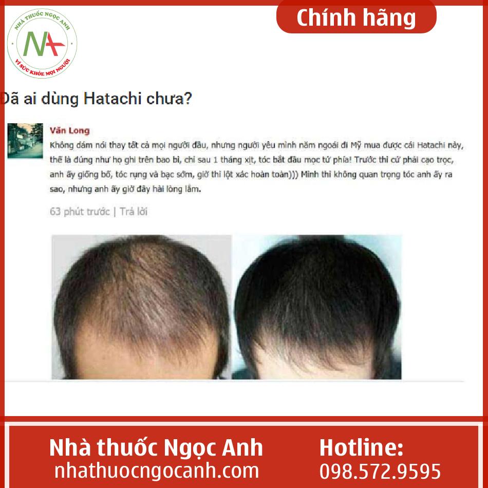 Viên uống hỗ trợ điều trị bạc tóc sớm rụng tóc Hatachi  Thực phẩm thuốc