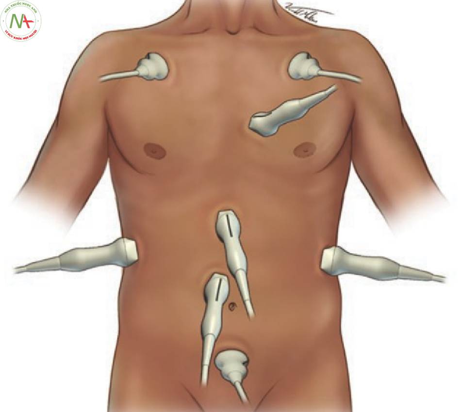 Hình 1 Hình ảnh này cho thấy vị trí đầu dò cho các mặt cắt trong RUSH
