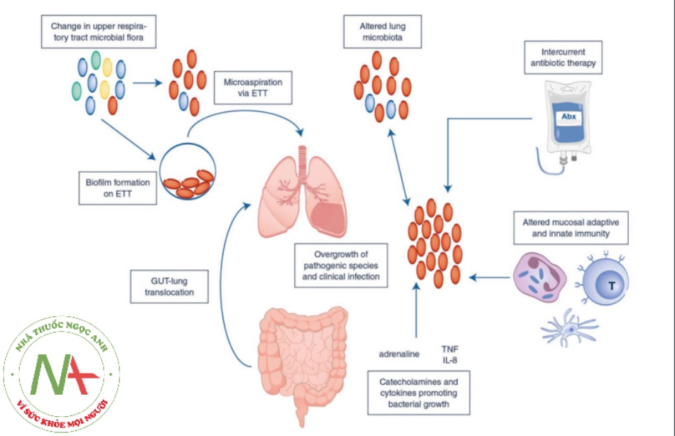 Các cơ chế dẫn đến thay đổi hệ vi sinh vật trong phổi và do đó gây nhiễm trùng. ETT: Ống nội khí quản, TNF: yếu tố hoại tử khối u, IL: interleukin