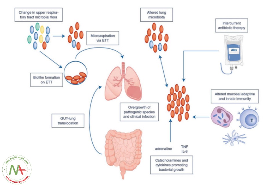 Các cơ chế dẫn đến thay đổi hệ vi sinh vật trong phổi và do đó gây nhiễm trùng. ETT: Ống nội khí quản, TNF: yếu tố hoại tử khối u, IL: interleukin