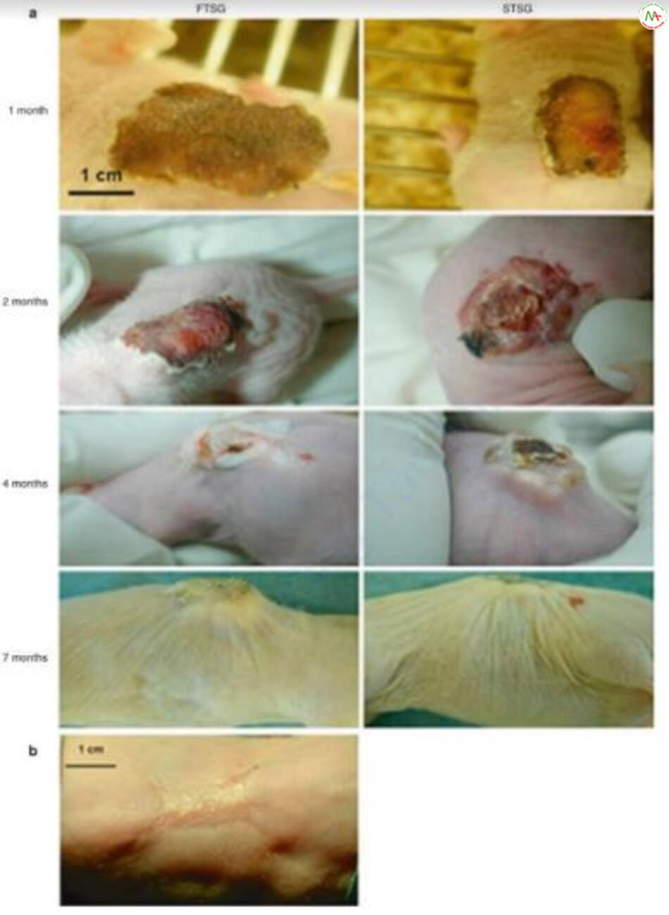 Hình 3.10 Cả mảnh ghép da người có độ dày đầy đủ (FTSG) và độ dày tách lớp (STSG) đều được ghépvào lưng của con chuột nude và sự tiến triển của sự hình thành sẹo được ghi lại vào thời điểm 1 tháng, 2 tháng, 4 tháng và 7 tháng sau ghép (a). Mảnh da chuột cũng được ghép tuy nhiên không hình thành sẹo (b) [133].