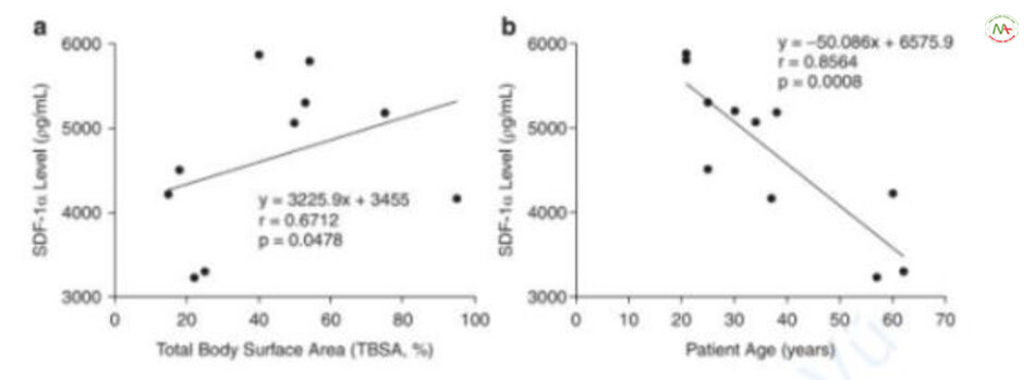 Hình 3.5 Đường truyền tín hiệu SDF-1/CXCR4 có liên quan đến sự hình thành sẹo phì đại. Ở bệnh nhânbỏng, nồng độ SDF-1 huyết thanh tỷ lệ thuận với tổng diện tích bề mặt cơ thể (TBSA) (a) và tỷ lệ nghịch với tuổi bệnh nhân (b) [36].