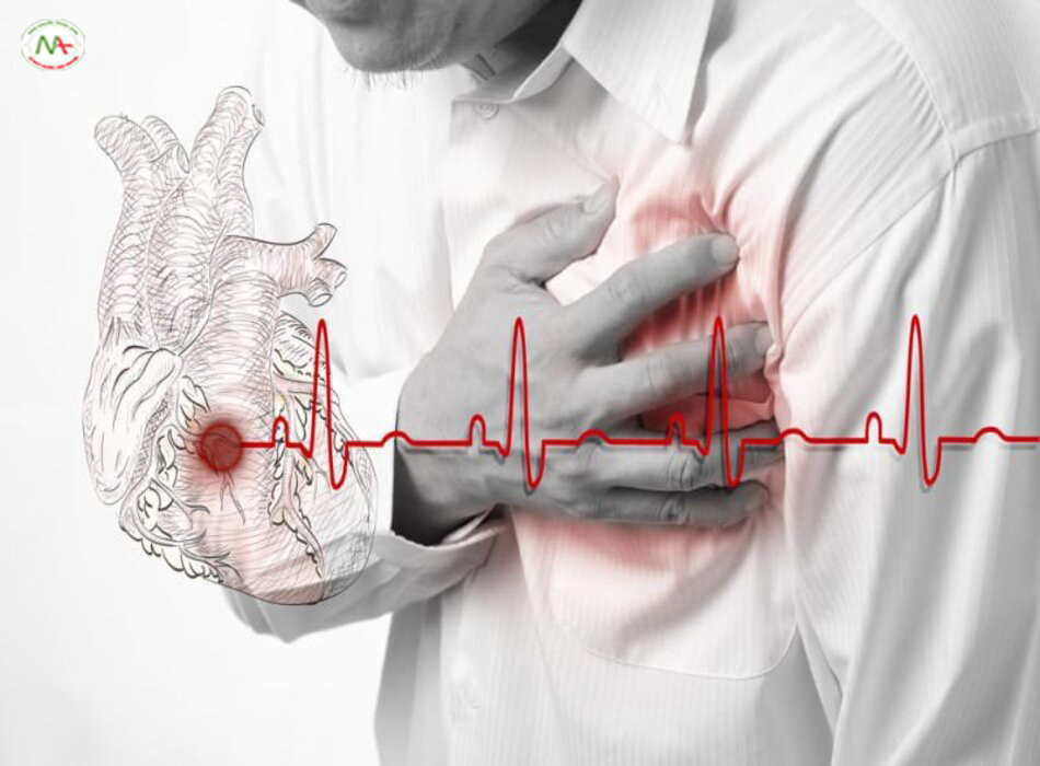 Suy tim mạn: Cơ chế bệnh sinh, chẩn đoán và điều trị