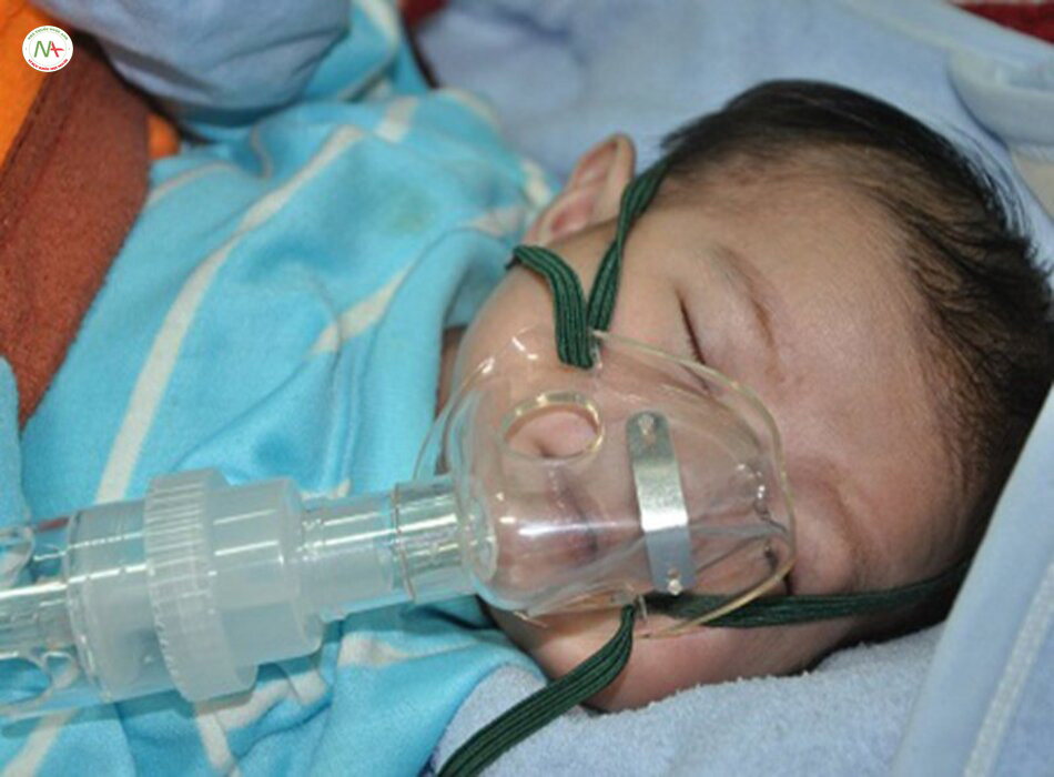 Các nguyên lý thông khí bảo vệ phổi trong thông khí hỗ trợ cho trẻ sơ sinh
