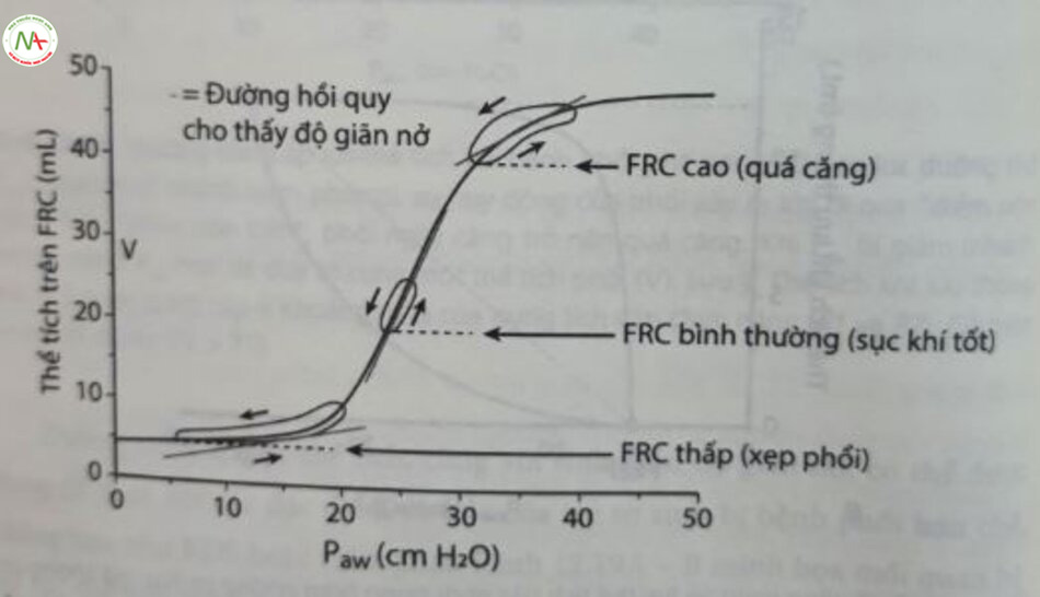 Hình 12.20 Đường cong áp lực-thể tích với bệnh phổi phế nang – vai trò của dung tích Cân chức năng (FRC). Thể tích khí lưu thông ở mức khoảng 6 mL được cung cấp với FRC tháp/bình thường/cao, dẫn đến sự thay đổi áp lực lớn/nhỏ/lớn. Độ giãn nở (đường thẳng màu xám) trong FRC binh thường cao hơn trong FRC thấp/cao. P… áp lực đường thời 