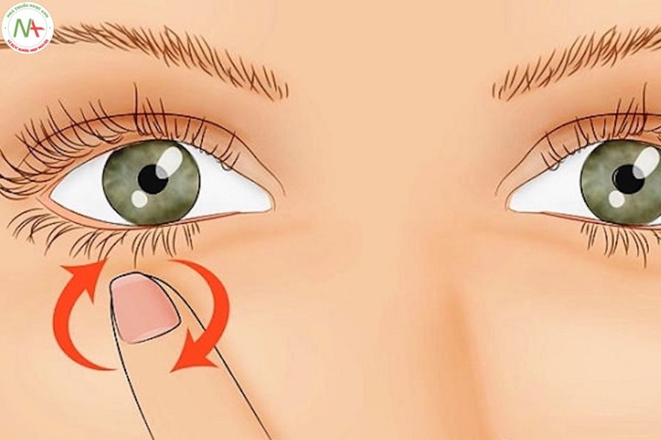 Biện pháp tránh các bệnh liên quan tới việc nháy mắt phải