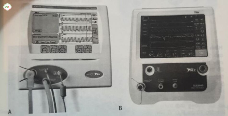 Hình 24.7 Máy thở tần số cao SLE 5000 (A) và 6000 (B). Các thiết bị này có khả năng thông khí theo cả chế độ thông thường lên tần số cao với mục tiêu thể tích. Các dao động được tạo ra bởi một cơ chế không van liên quan đến các tia phản lực hưởng về phía trước và phía sau, luân phiên đưa khi vào bệnh nhân và tạo điều kiện thỏ ra chủ động. Tỷ lệ hít vào thở ra có thể điều chỉnh từ 11 đến 13 và tần số có thể điều chỉnh lên đến 20 Hz. Thở sâu được áp dụng ở áp lực và thời gian hút vào có thể điều chỉnh. Các giá trị đạt và giá trị đo được hiển thị. (Được sự cho phép của SLE, South Croydon, Vương quốc Anh).