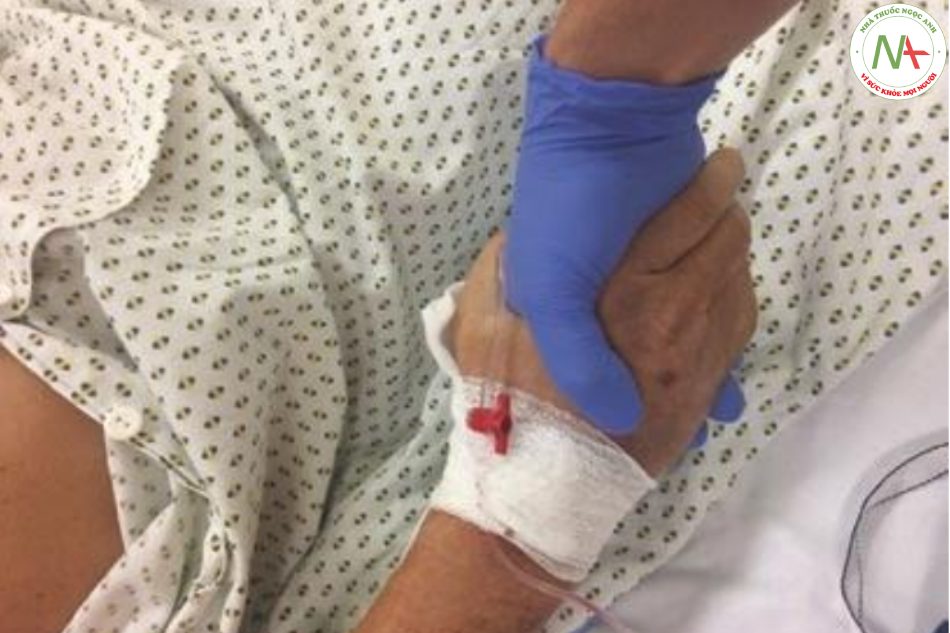 Hình 11.1 Sức mạnh của tay cầm giảm có liên quan đến Hội chứng yếu cơ mắc phải tại ICU và là kết quả ở bệnh nhân bị bệnh nặng