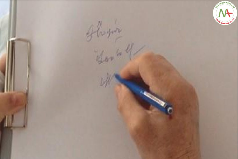 Hình 9.7 Chữ viết tay bị suy yếu có thể là dấu hiệu của bệnh não gan với phân độ thấp nhưng không đặc hiệu ở bệnh nhân bị bệnh nặng