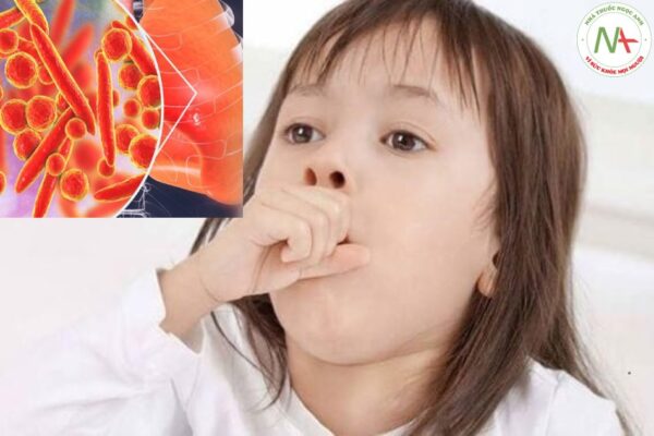 Nhiễm Mycoplasma pneumoniae ở trẻ em