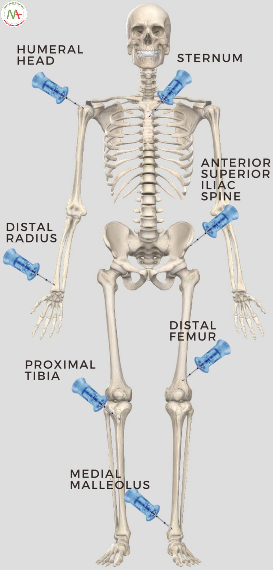 Vị trí đặt đường truyền trong xương ở người lớn
