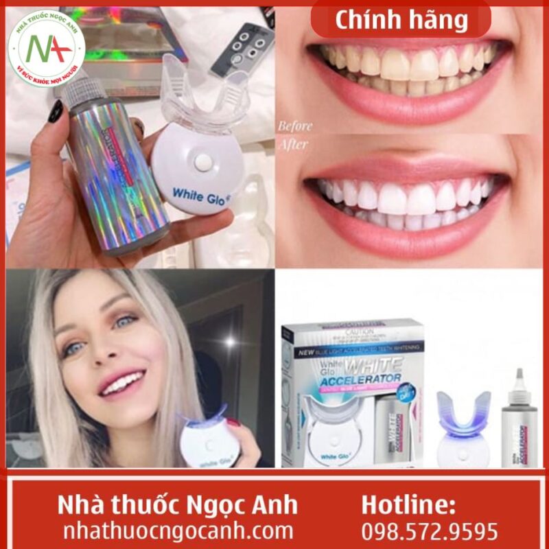 Máy làm trắng răng White Glo Accelerator review, giá bao nhiêu, mua ở đâu