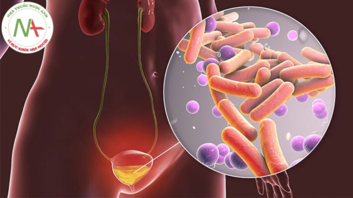 Điều trị kháng sinh cho các nhiễm khuẩn đường tiết niệu - sinh dục