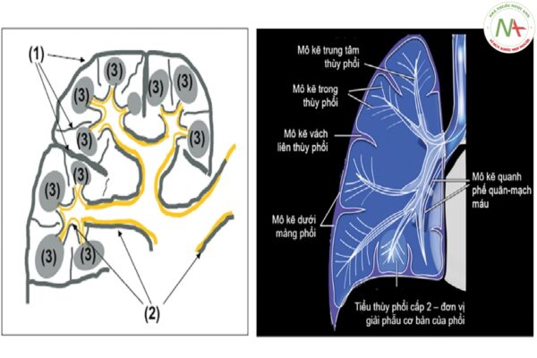 Sơ đồ phân loại và định khu các khoảng mô kẽ phổi: 1) Mô kẽ dưới màng phổi; 2) Mô kẽ dẫn hay mô kẽ trục quanh phế quản - mạch máu; 3) Mô kẽ thành - phế nang.