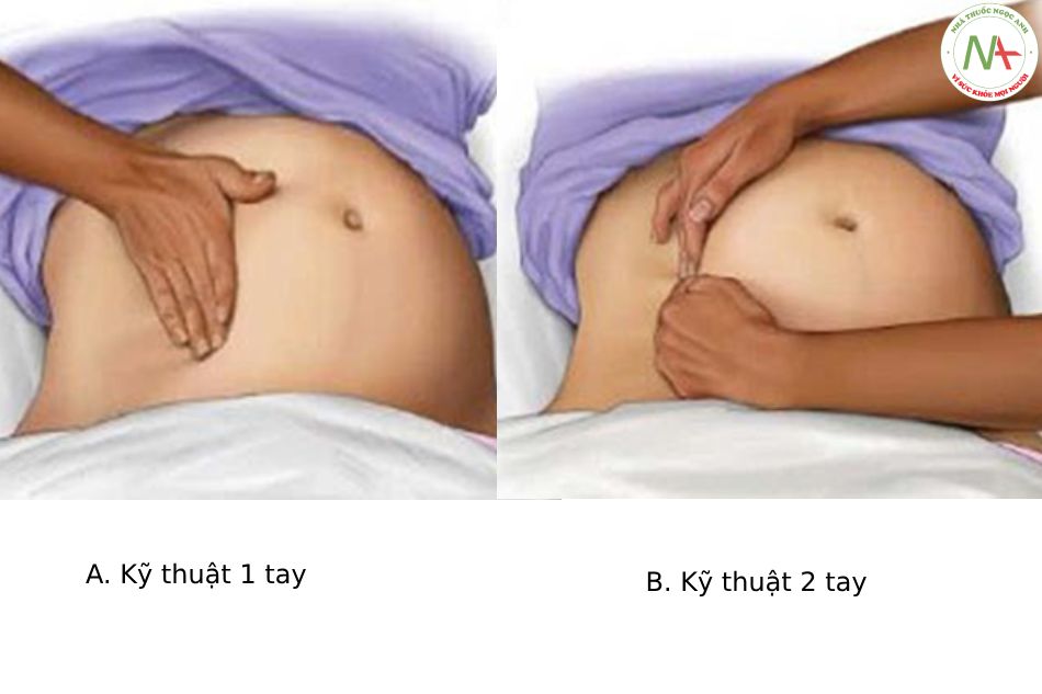 Hình 5. Thủ thuật dịch chuyển tử cung sang bên trái.