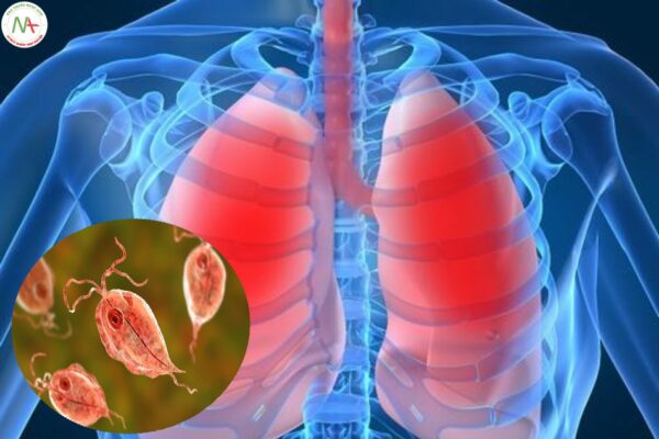Bệnh phổi do ký sinh trùng
