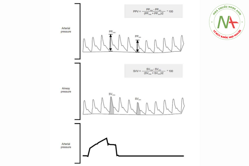 Hình 1. Biến thiên PP và biến thiên SV. Trong quá trình hít vào ở thở máy áp lực dương, sự gia tăng áp lực trong lồng ngực dẫn đến tăng tiền tải của tim, dẫn đến PP và SV lớn nhất khi kết thúc hít vào. Ngược lại, áp lực trong lồng ngực giảm khi thở ra, dẫn đến giảm PP và SV. Do đó, PP và SV nhỏ nhất khi thở ra. PP: áp suất mạch, SV: thể tích nhát bóp, PPV: biến thiên áp suất mạch, SVV: biến thiên thể tích nhát bóp.