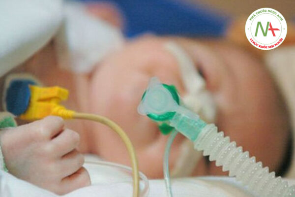 Hiểu về thông khí cho trẻ em trong môi trường phẫu thuật