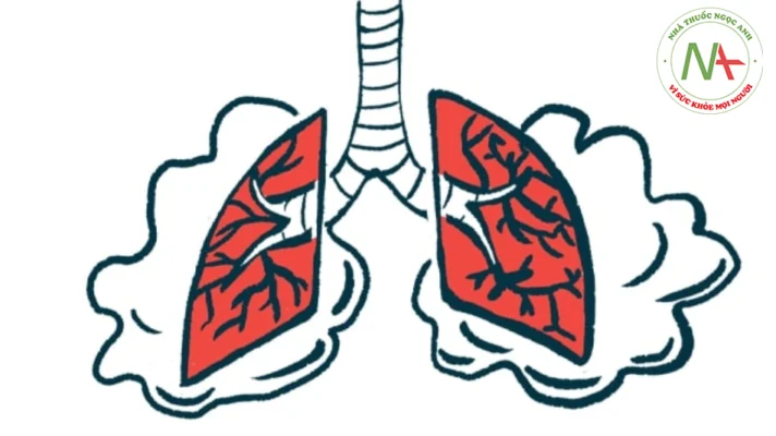 Bệnh phổi do amip nguyên phát giả u trên bệnh nhân suy giảm miễn dịch