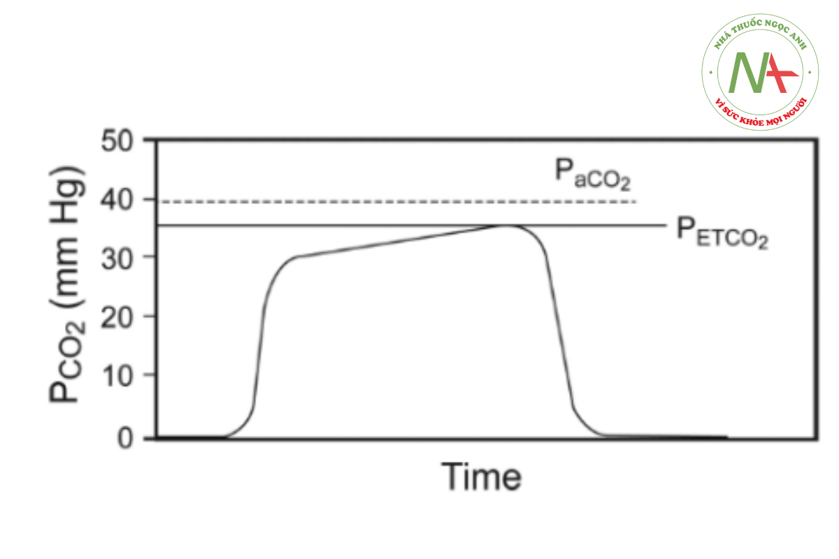 Hình 1. Capnogram dựa trên thời gian bình thường cho thấy sự khác biệt giữa PaCO2 và áp suất riêng phần của CO2 cuối triều (PETCO2), thường là 2–5 mm Hg.