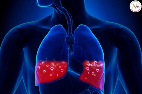 Thông khí cơ học ở bệnh nhân phù phổi do tim