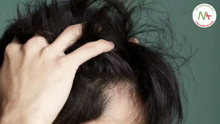 Bệnh lý tóc (Hair disorders)
