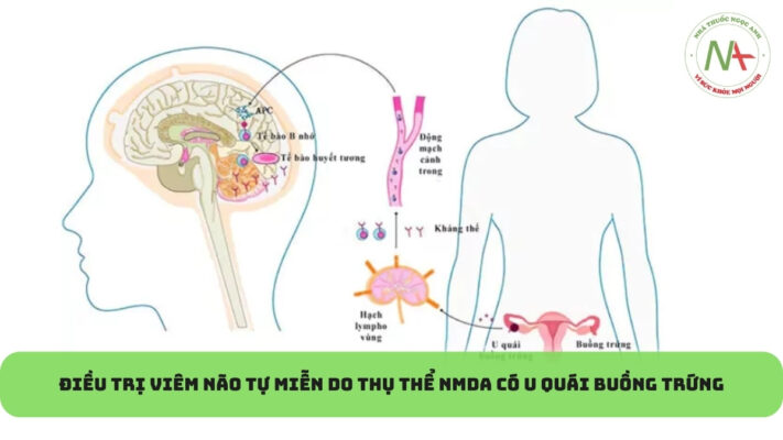 Điều trị viêm não tự miễn do thụ thể NMDA có u quái buồng trứng - Bệnh viện Bạch Mai