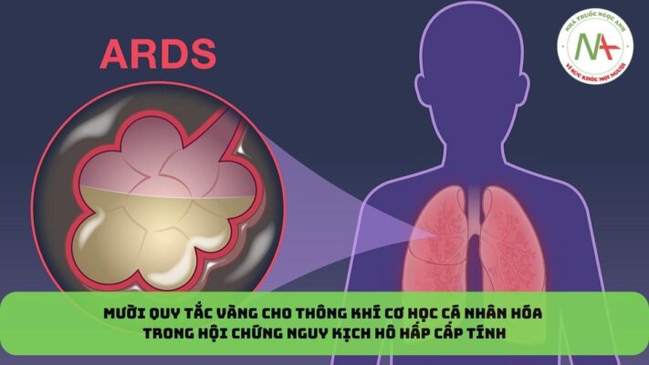Mười quy tắc vàng cho thông khí cơ học cá nhân hóa trong hội chứng nguy kịch hô hấp cấp tính